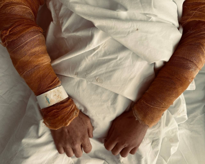 Двое мужчин получили серьезные ожоги паром в одной из общественных бань Казани