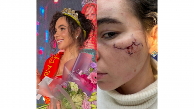 Девушку, приехавшую в Казань на концерт в &laquo;Корстоне&raquo;, жестко избили в туалете